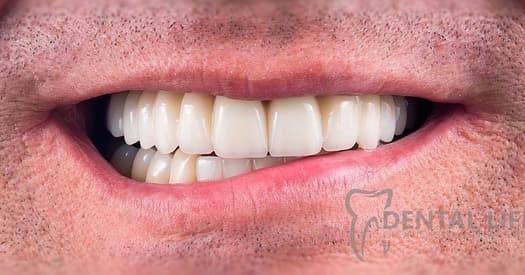 Planejamento digital odontológico para tratamentos personalizados.